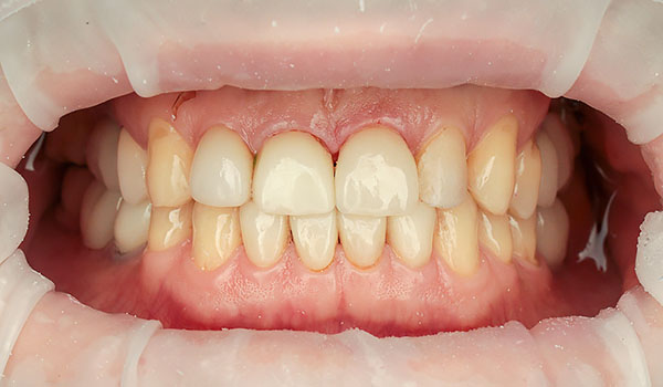Case 1 Before